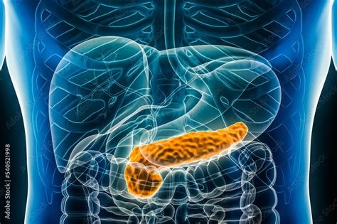 Insulin Resistance Explained